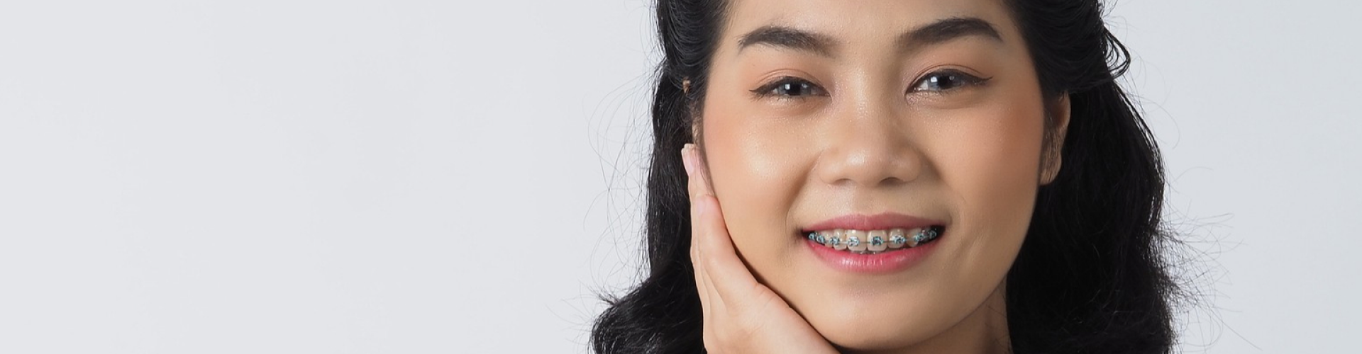 Close-up of a smiling woman wearing traditional metal braces on her teeth.